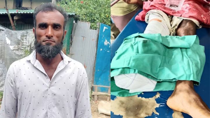 উখিয়ায় মাইন বিস্ফোরণে বাংলাদেশি আহত